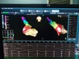 我院心内科首次使用电学导航三维标测系统完成射频消融术